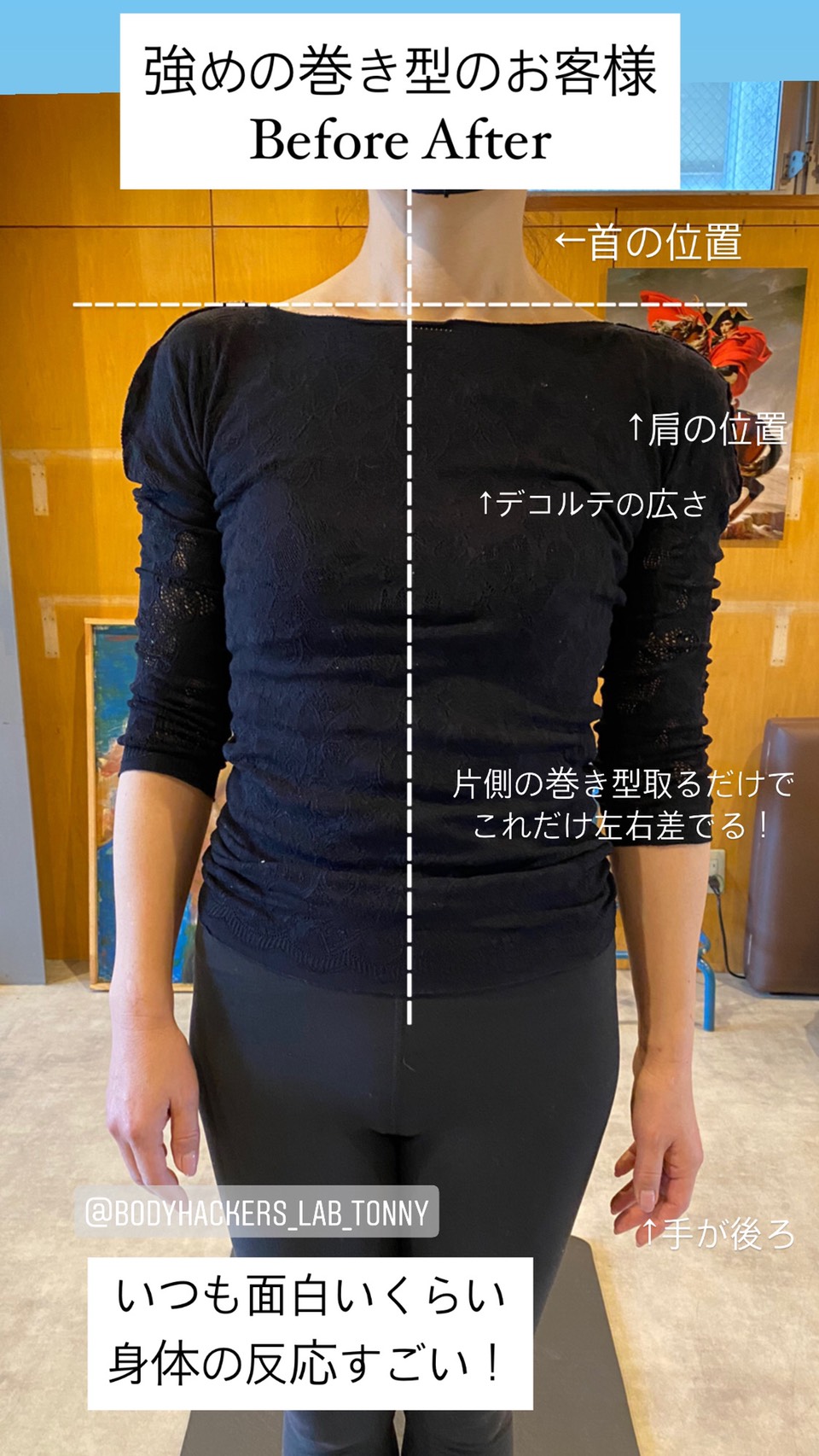 女性の姿勢改善（before/after）@福岡プライベートジム