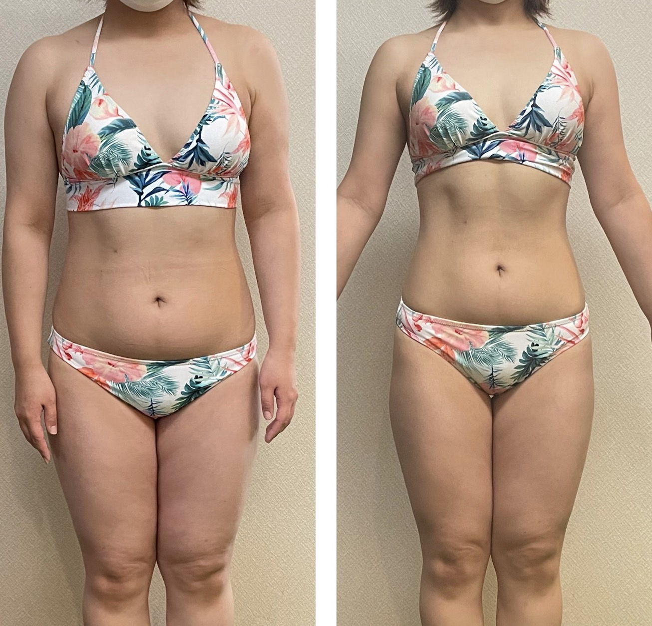 2ヶ月の女性ダイエットボディメイクモニター結果！見た目も劇的に変わりました