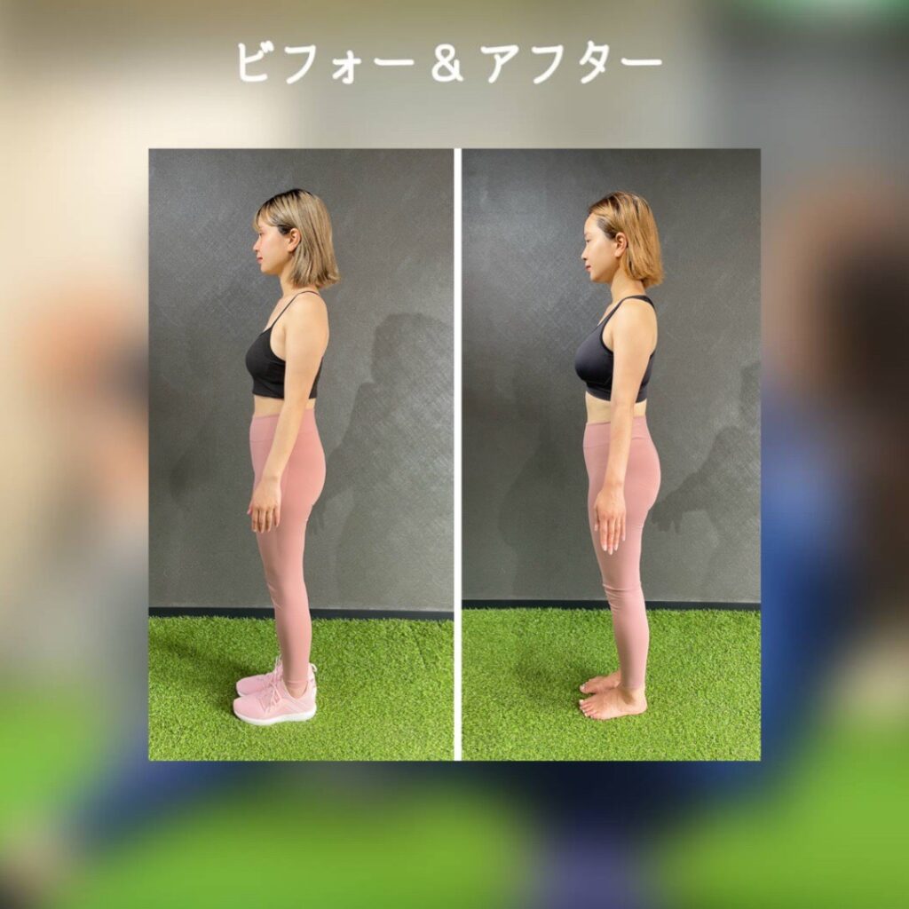 通い放題コースビフォーアフター！お仕事が多忙な中、時間を作ってしっかりと結果に結びつきました