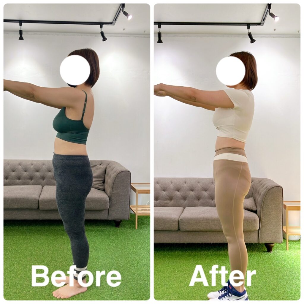 お腹周りがスッキリした大橋店のお客様Before After